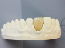 Zahntechnik und Zahnersatz München - Pearl Dental e.K.