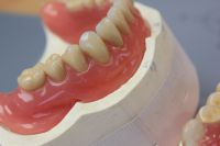 zahntechnik-labor-muenchen-pearl-dental-22-2015